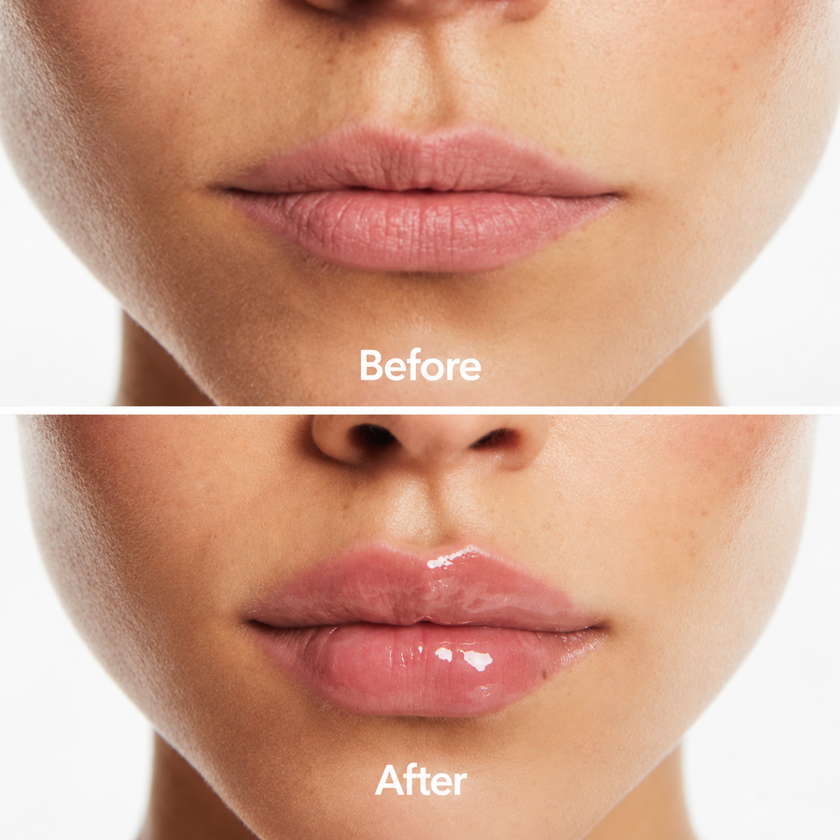 Lipserum