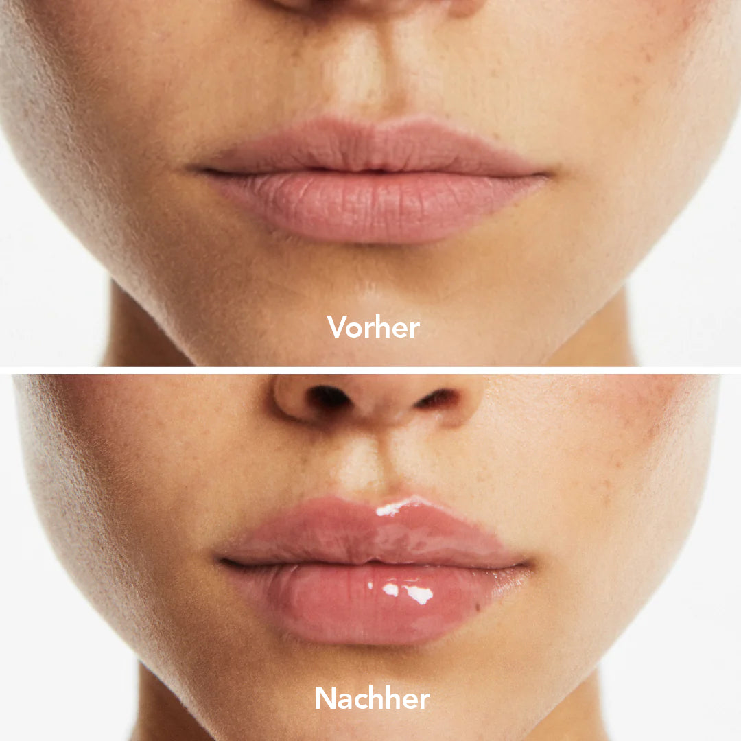 Lipserum