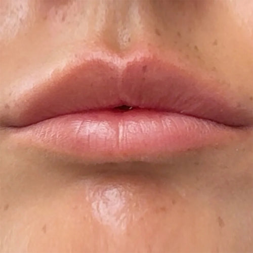 Breng het aan op je lippen